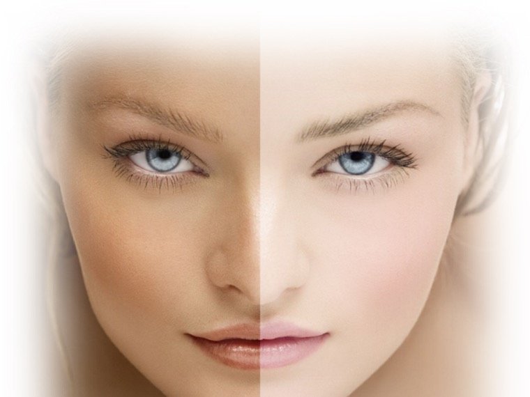 Uneven pigmentation on facial skin